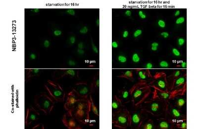 <b>Biological Strategies Validation. </b>Immunocytochemistry/Immunofluorescence: Smad2 [p Ser465, p Ser467] Antibody [NBP3-13273] - Smad2 (phospho Ser465/Ser467) antibody detects Smad2 (phospho Ser465/Ser467) protein at nucleus by immunofluorescent analysis. Sample: Mock and treated HeLa cells were fixed in 4% paraformaldehyde at RT for 15 min. Green: Smad2 (phospho Ser465/Ser467) stained by Smad2 (phospho Ser465/Ser467) antibody (NBP3-13273) diluted at 1:1500. Red: phalloidin, a cytoskeleton marker, diluted at 1:100. Scale bar= 10 um.